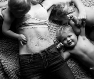 抹预防妊娠纹的精油手法,妊娠纹预防油推荐