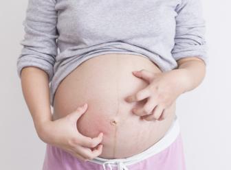 抹预防妊娠纹的精油手法,妊娠纹预防油推荐