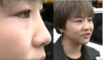 花了30万整的鼻子,花了10万整的鼻子