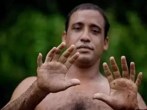 快速成型3d打印,3d打印再造手指技术