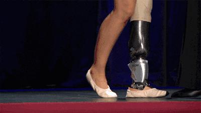 快速成型3d打印,3d打印再造手指技术