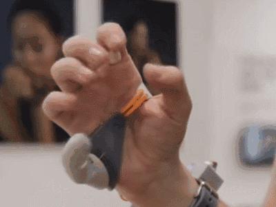 快速成型3d打印,3d打印再造手指技术