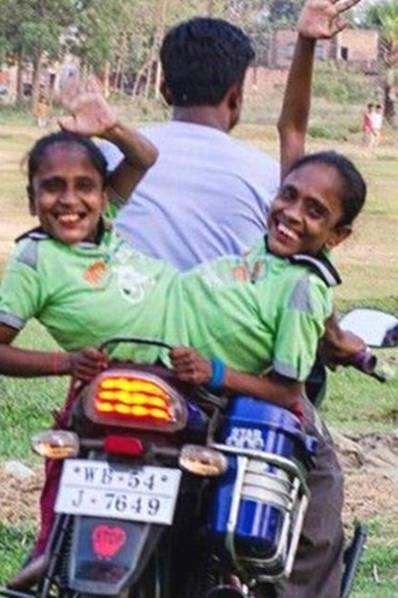 连体婴姐妹其中一个结婚了,连体姐妹一人结婚视频完整版