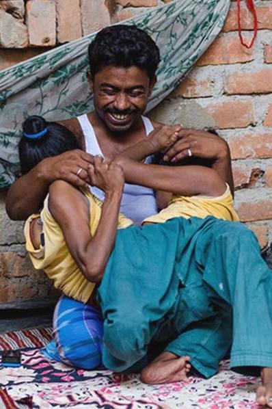 连体婴姐妹其中一个结婚了,连体姐妹一人结婚视频完整版