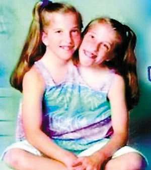 连体婴姐妹其中一个结婚了,连体姐妹一人结婚视频完整版