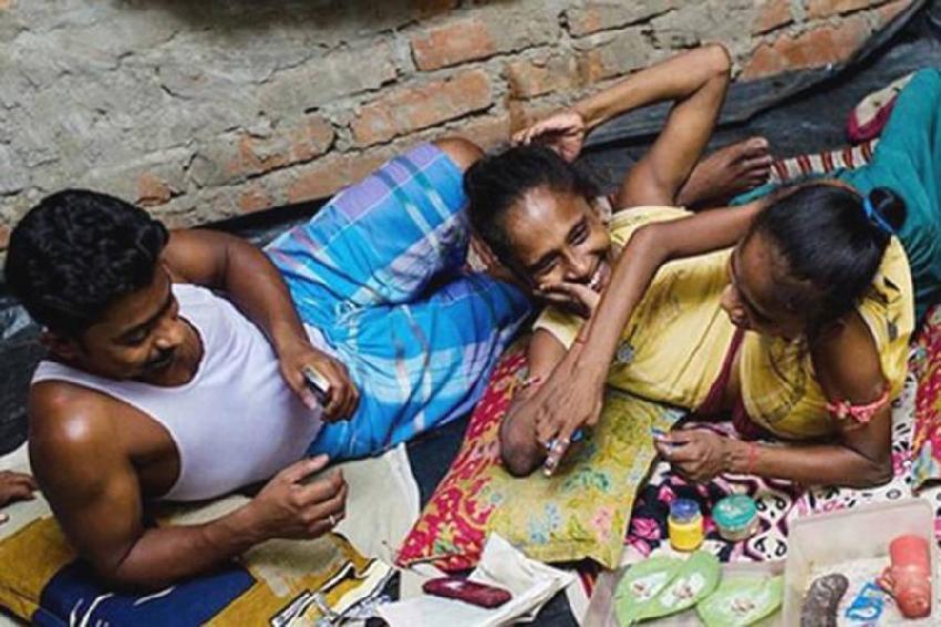 连体婴姐妹其中一个结婚了,连体姐妹一人结婚视频完整版