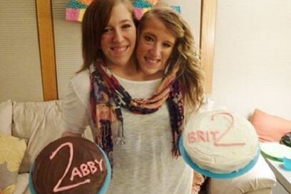 连体婴姐妹其中一个结婚了,连体姐妹一人结婚视频完整版