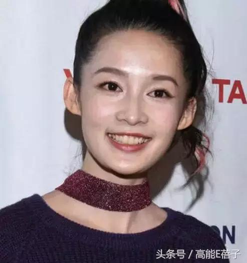 高圆圆牙齿美白,高圆圆40岁美白秘诀