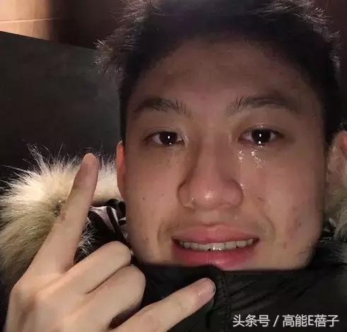 高圆圆牙齿美白,高圆圆40岁美白秘诀