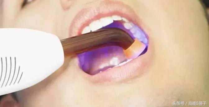 高圆圆牙齿美白,高圆圆40岁美白秘诀