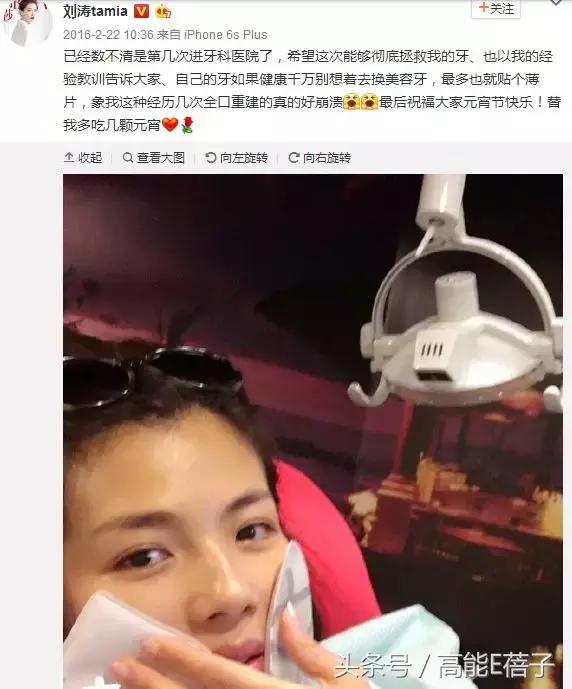 高圆圆牙齿美白,高圆圆40岁美白秘诀