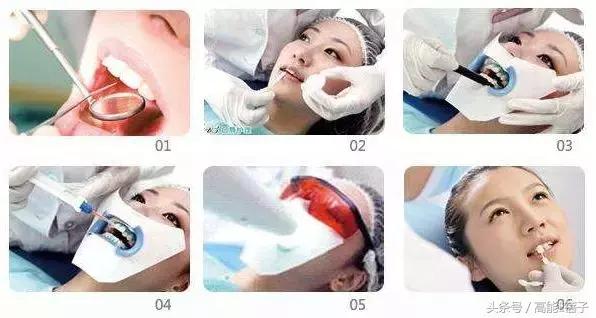 高圆圆牙齿美白,高圆圆40岁美白秘诀