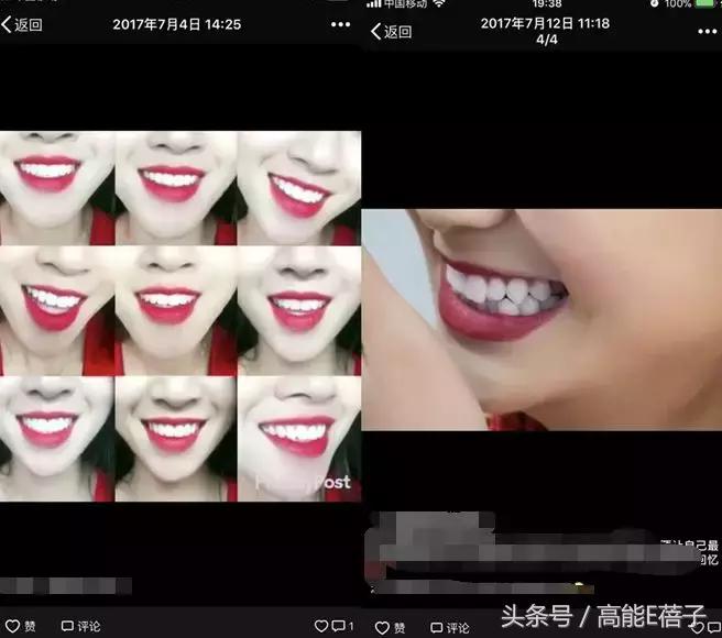 高圆圆牙齿美白,高圆圆40岁美白秘诀