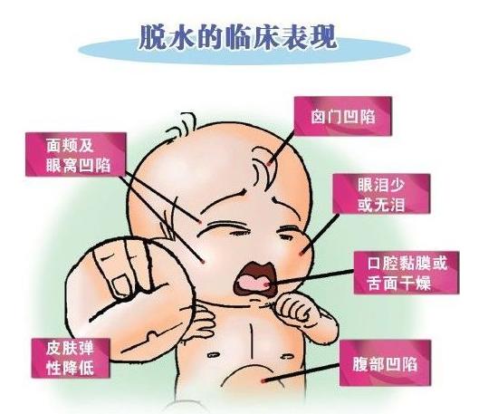 消化不良拉肚子饮食方面注意什么,宝宝消化不良拉肚子怎样算有好转