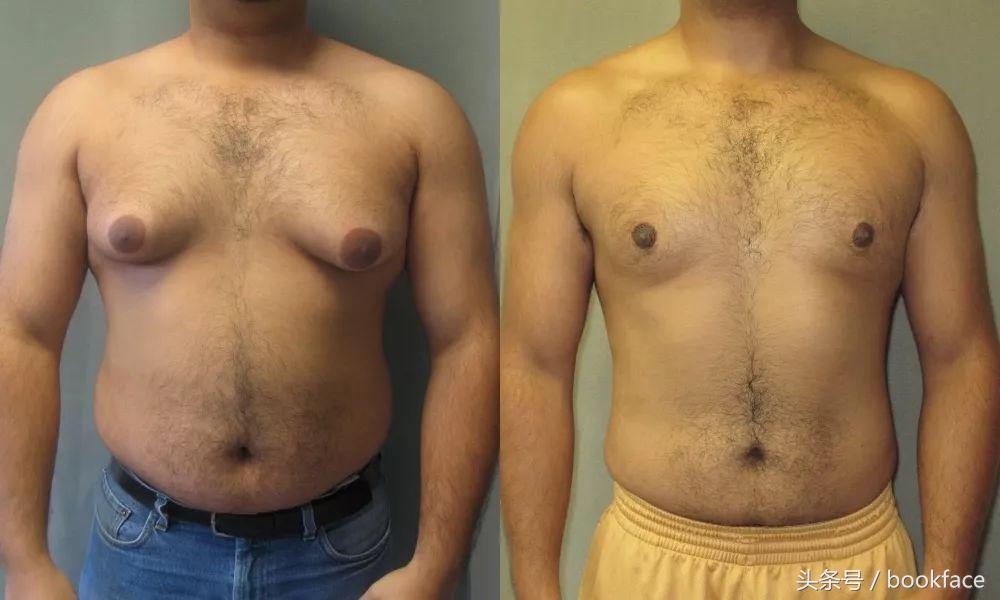 又不用喂奶，男人为什么要长乳头？
