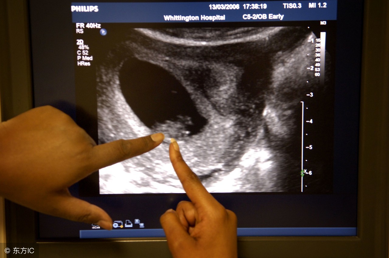 去医院检查b超需要做什么,去医院查b超一般是查什么