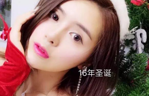 张琪格揭露整容谣言真相，并附上近两年照片供对比！