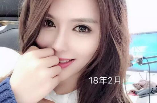 张琪格揭露整容谣言真相，并附上近两年照片供对比！