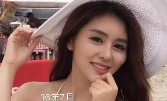 张琪格揭露整容谣言真相，并附上近两年照片供对比！