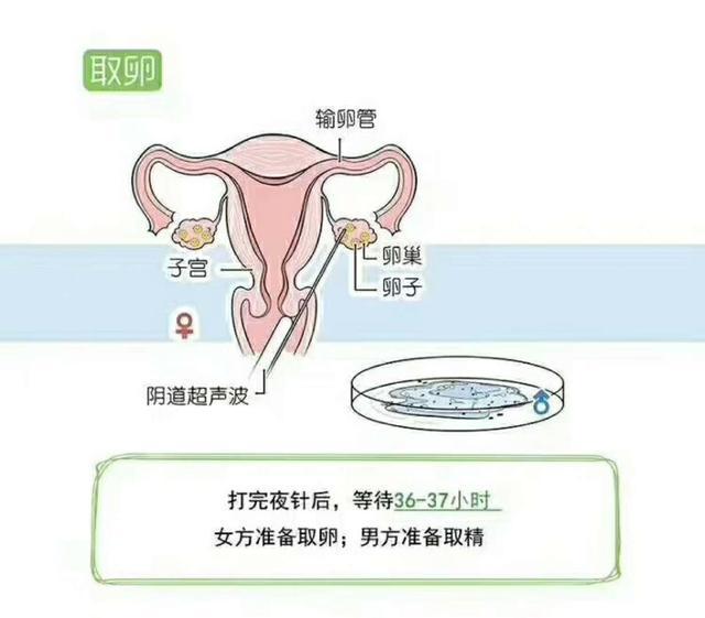 试管婴儿有什么操作费吗,第一次试管受孕多少钱