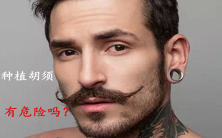 胡子种植好不好,胡子种植毛囊