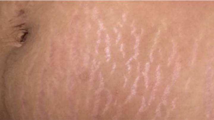 生了孩子后的症状,生孩子后身体开始出现各种毛病