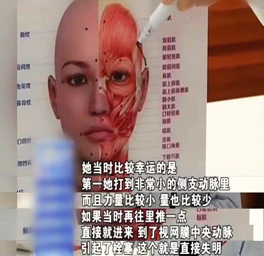姐妹互打玻尿酸差点毁容,网购玻尿酸注射结果内幕大曝光