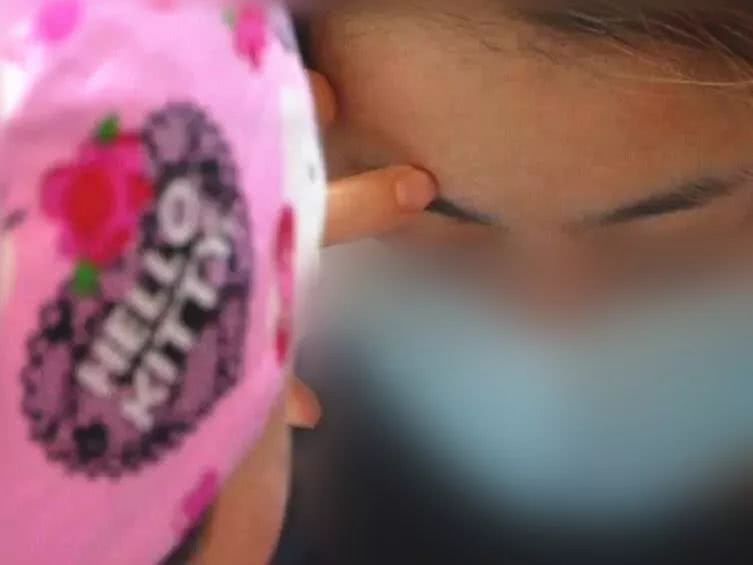 姐妹互打玻尿酸差点毁容,网购玻尿酸注射结果内幕大曝光