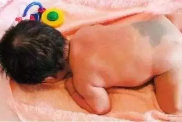 新生儿常见生理现象及护理,新生儿正常生理现象