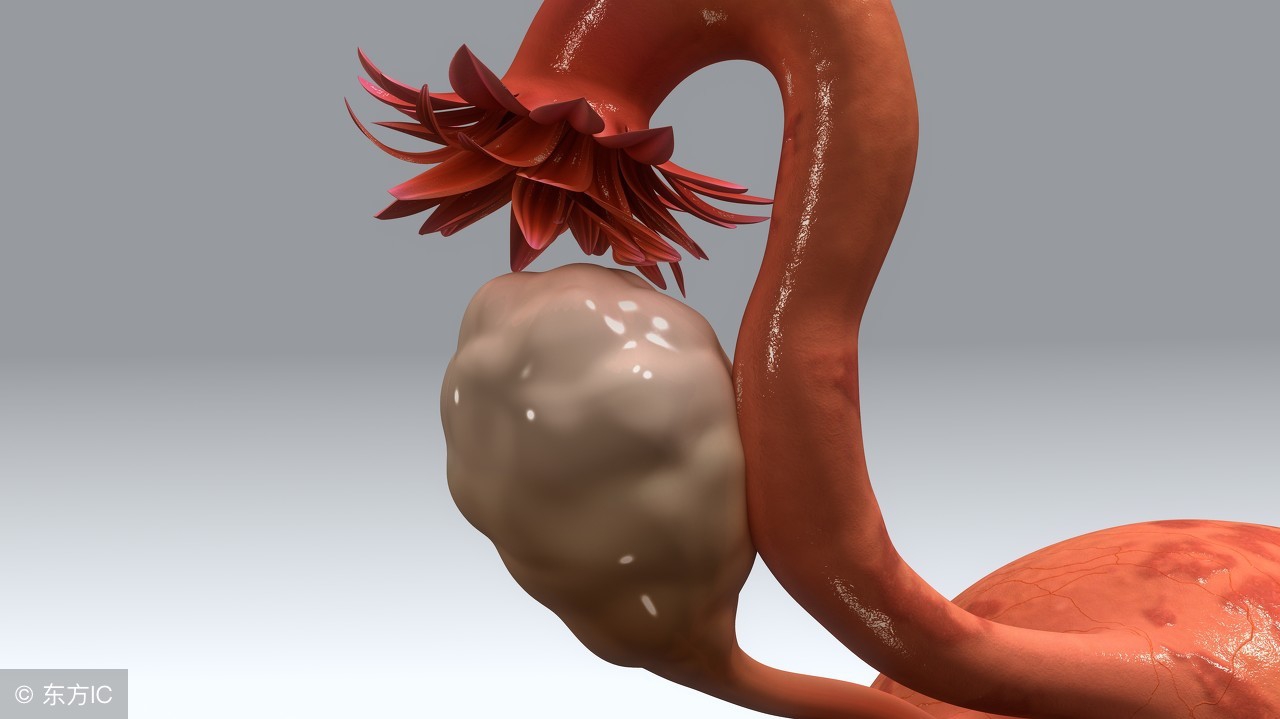 宫颈息肉不治疗会有什么后果,宫颈息肉可以不用治疗吗