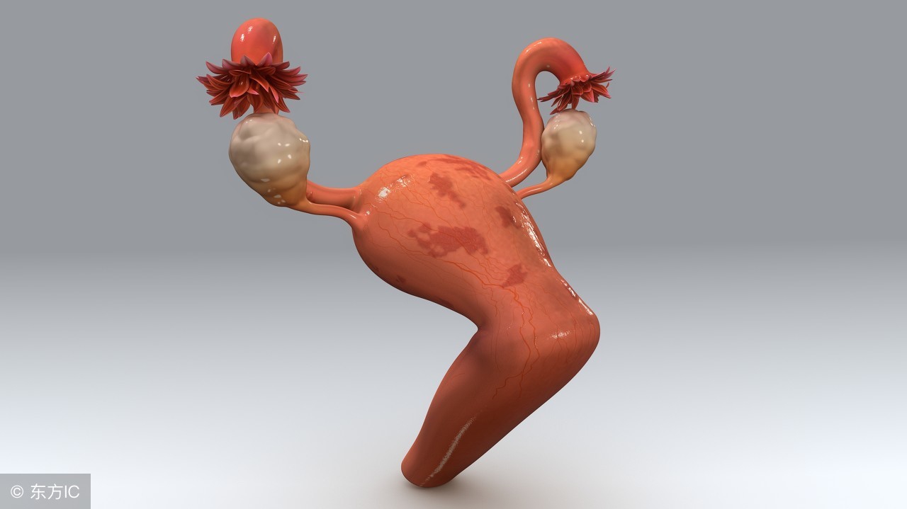 宫颈息肉不治疗会有什么后果,宫颈息肉可以不用治疗吗