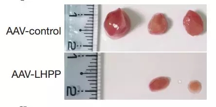 肝癌大突破!拉斯克奖大牛发现全新抑癌蛋白