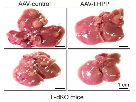 肝癌大突破!拉斯克奖大牛发现全新抑癌蛋白
