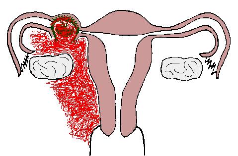 孕期九周少量见红是什么原因,见红五天了还没动静什么原因