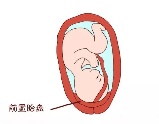 孕期九周少量见红是什么原因,见红五天了还没动静什么原因