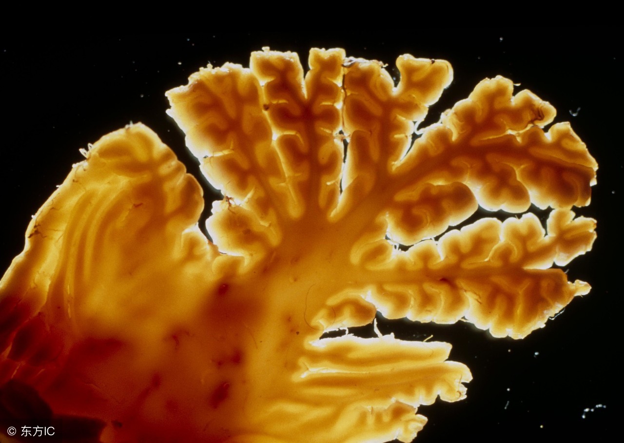 小脑萎缩犯法负法律责任吗,脑梗小脑萎缩什么方法治愈最好