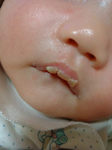 宝宝嘴唇易脱皮，妈妈别手贱再给撕掉了，三招还宝宝水嘟嘟的嘴唇