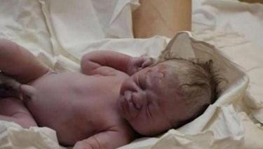 顺产与剖腹产的深度对比分析