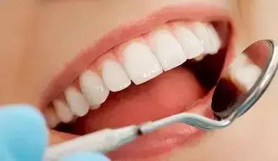 牙医建议烤瓷不建议全瓷,牙医建议整牙吗