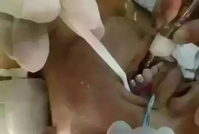 牙医建议烤瓷不建议全瓷,牙医建议整牙吗