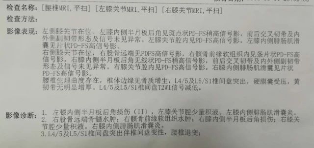 蔡赟谈林丹为什么不适合打双打,蔡赟技术讲解