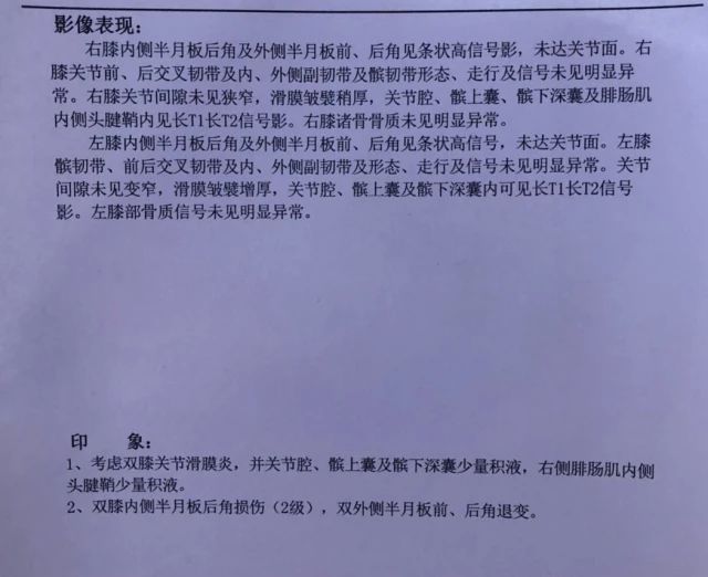 蔡赟谈林丹为什么不适合打双打,蔡赟技术讲解