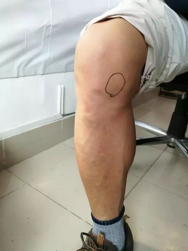 蔡赟谈林丹为什么不适合打双打,蔡赟技术讲解