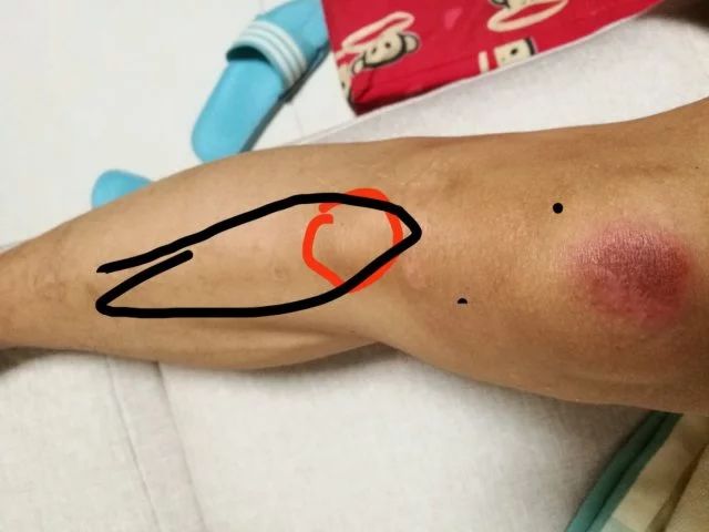 蔡赟谈林丹为什么不适合打双打,蔡赟技术讲解