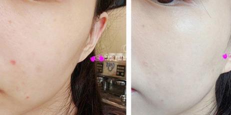 蒂佳婷银管bb霜裸妆推荐,油皮必入的大牌精华