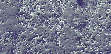 口臭根本不是牙齿的问题,口臭不臭自己知道吗