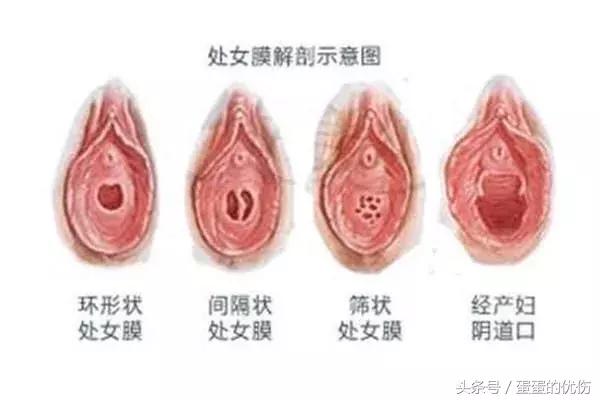 22岁女生怀孕了该咋办,20岁未婚女生怀孕该怎么办