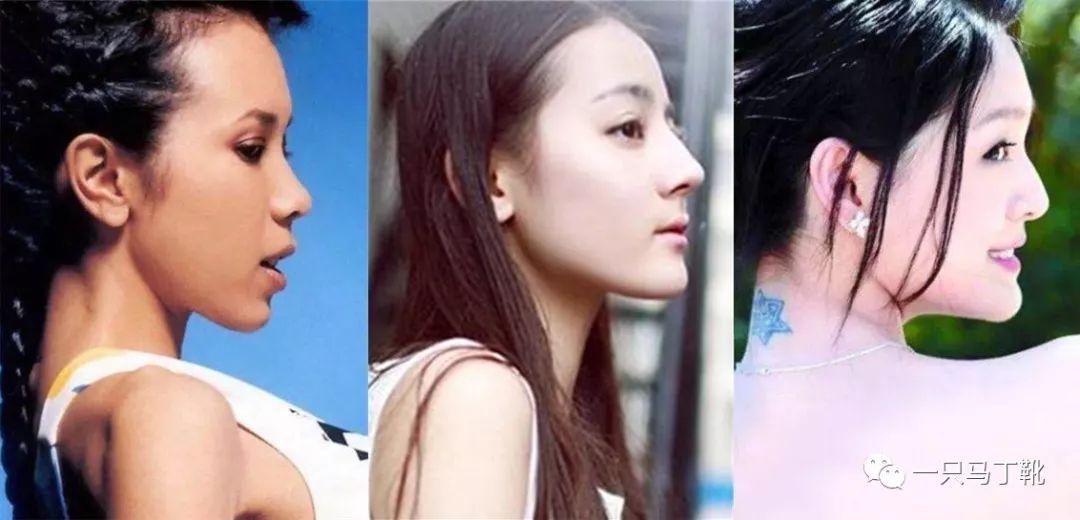 凸下巴凹面型脸怎么改变,脸宽但下巴尖怎么瘦下来