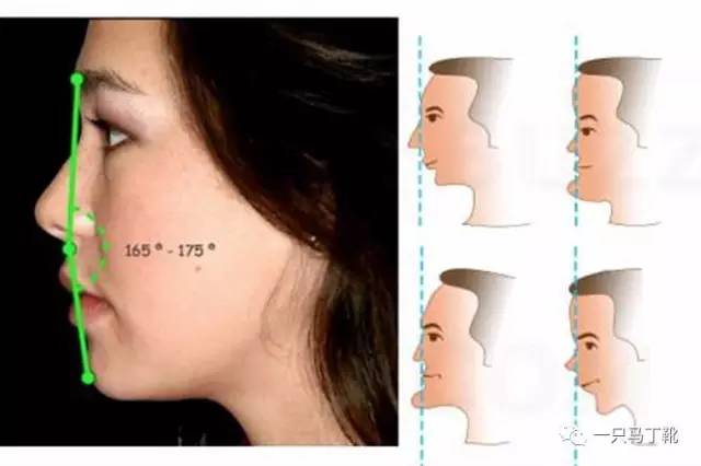 凸下巴凹面型脸怎么改变,脸宽但下巴尖怎么瘦下来