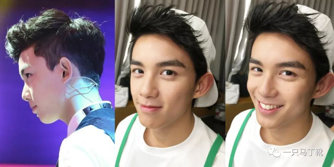 凸下巴凹面型脸怎么改变,脸宽但下巴尖怎么瘦下来